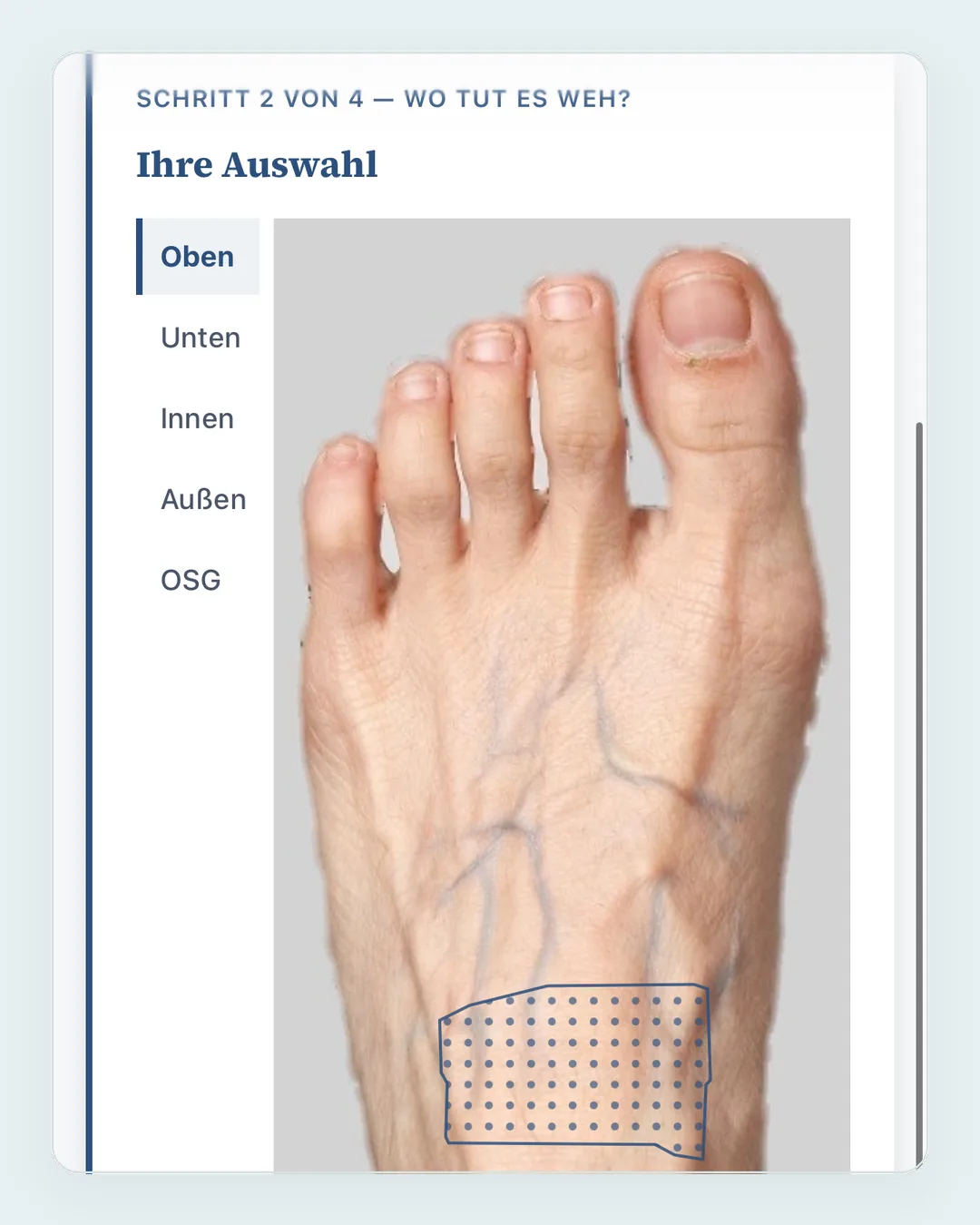 Beschwerde-Wegweiser der Patienten-App mit Auswahl der Beschwerderegion